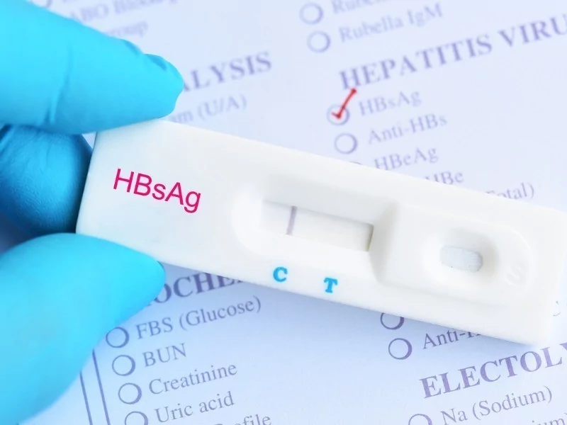 ANTI HBs TOTAL