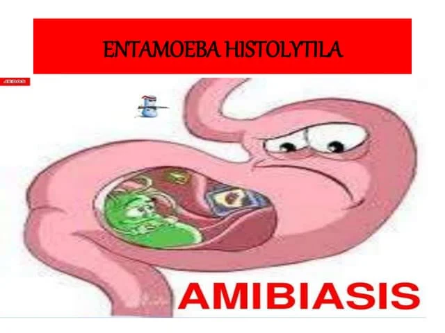 Amoebic Serology Test