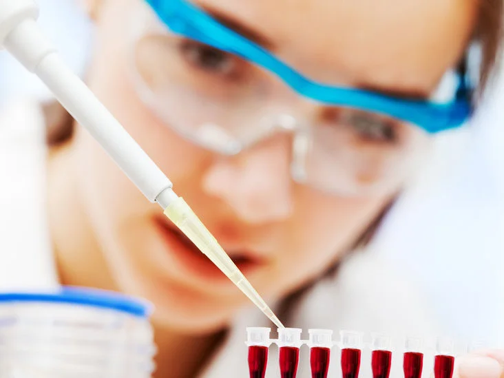 amylase-blood_ Test