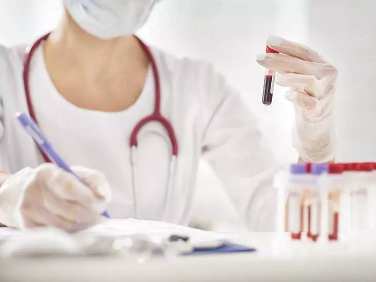 anti-nuclear-antibody-test-64abc25989ecf