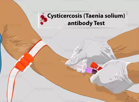 anti-taenia-solium-cysticercosis-64abd1c250722