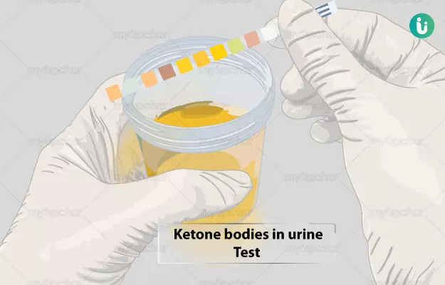 ketones-in-urine