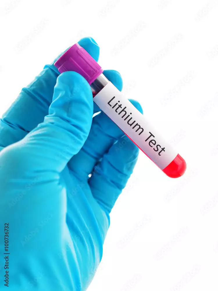lithium-64ac019405f3d