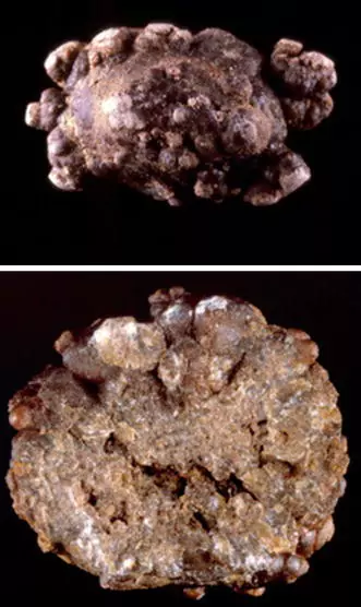stone-analysis-qualitative-64ad186db4c80